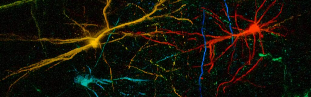 Catching human neurons in action: in vivo calcium imaging of human pluripotent stem cell–derived cortical pyramidal neurons transplanted in the mouse visual cortex. (Photo: Ben Vermaercke, Bonin and Vanderhaeghen Laboratories)