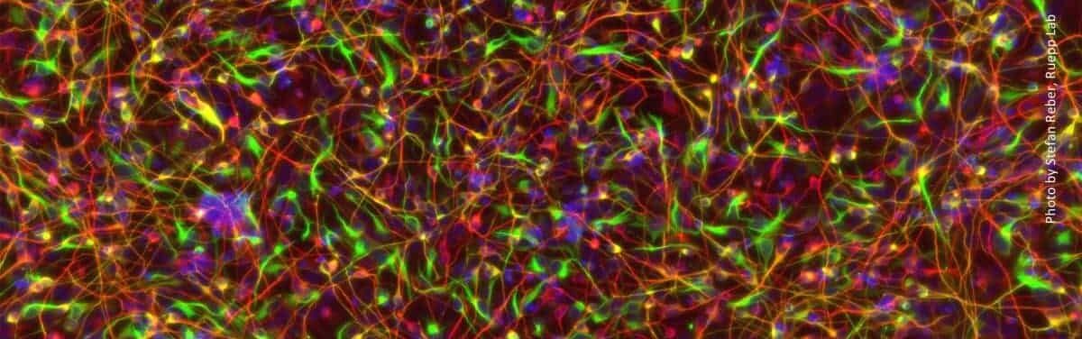 Elucidation of Selective Motor Neuron Death in Amyotrophic Lateral ...