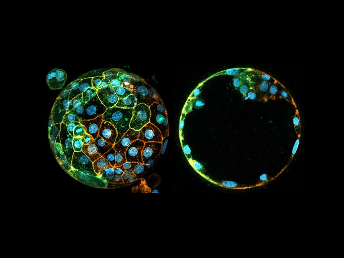 Fetal Cells Can Be Traced Back to the First Day of Embryonic Development