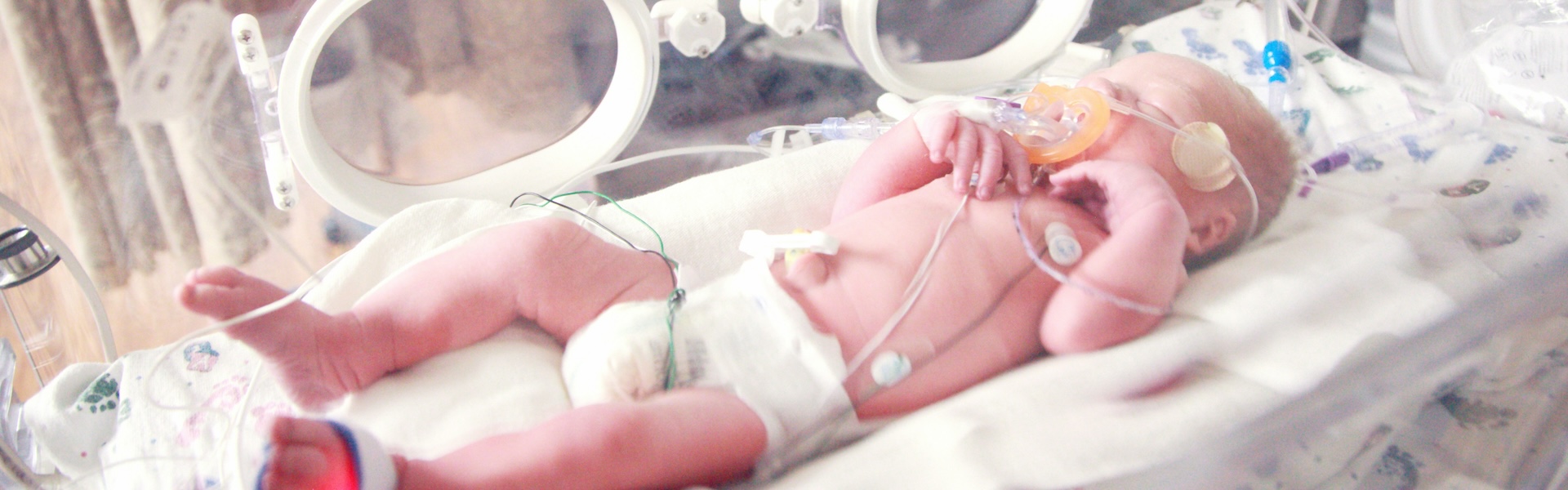 newborn baby getting profesional treatment at the hospital
