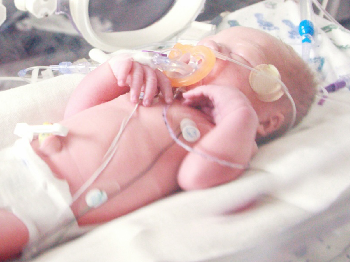 Luregn Schlapbach leads The Lancet series on pediatric sepsis